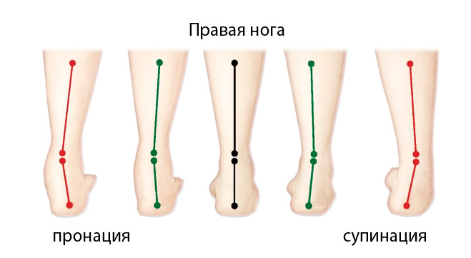 нога 