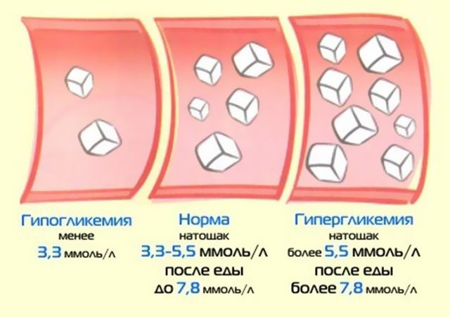 Каротиноиды &laquo;выключают&raquo; ген диабета 