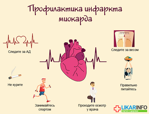 Инфаркт у женщин &ndash; атипичные